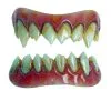 Dental FX Veneers Grimm-Zähne