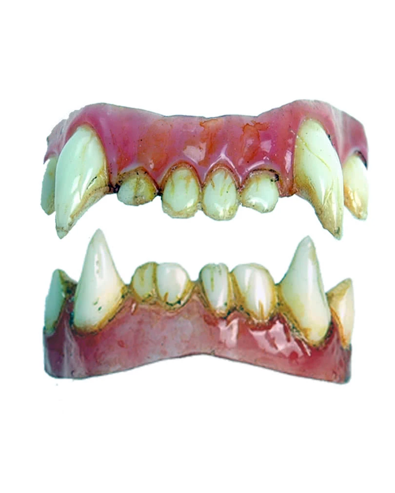 Dental FX Veneers Werwolf-ZĂ€hne